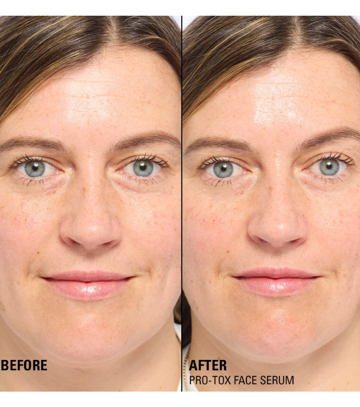 Revolution Pro - *Miracle Pro-Tox* - Siero viso riparatore e riempitivo di linee