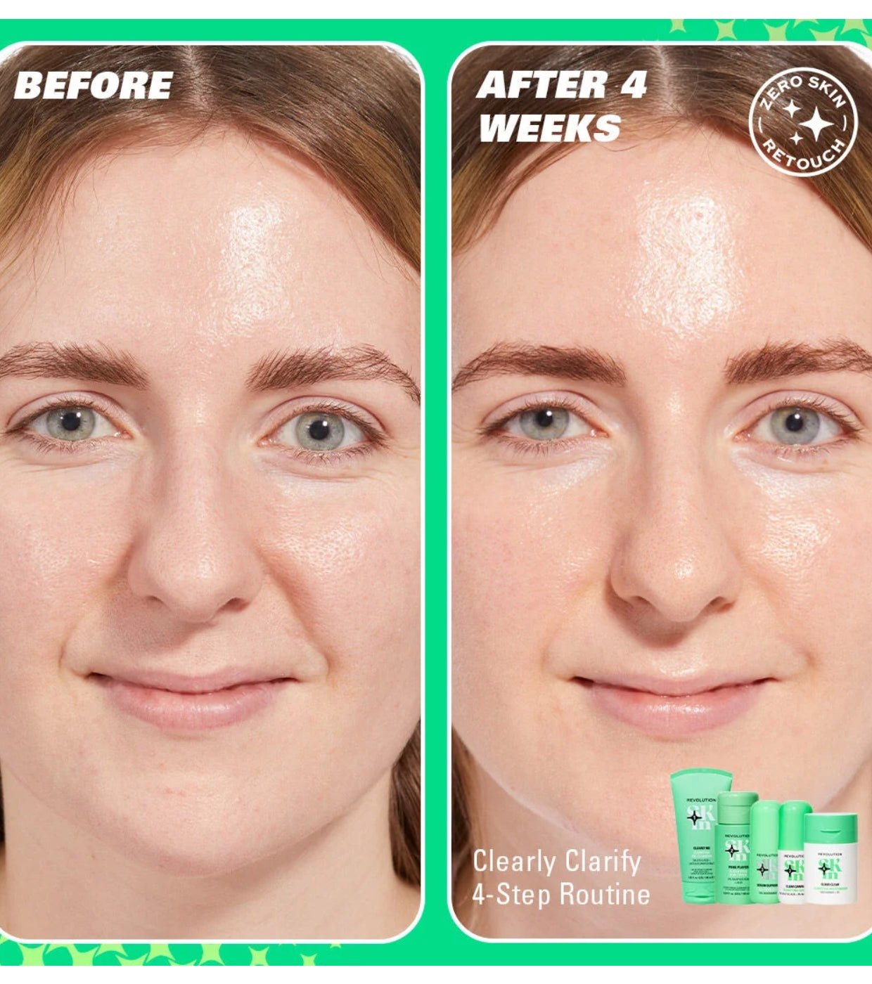 Revolution Skin - *Clearly Clarify* - Siero viso purificante Serum Supreme